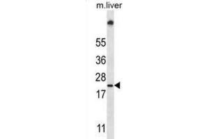 Western Blotting (WB) image for anti-Ubiquitin-Conjugating Enzyme E2W (UBE2W) antibody (ABIN2997430) (UBE2W Antikörper)