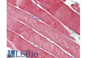 ABIN5539515 (5µg/ml) staining of paraffin embedded Human Skeletal Muscle. (DNAJC5 Antikörper  (AA 177-191))