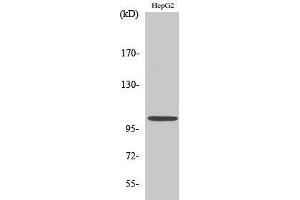 Western Blotting (WB) image for anti-Nuclear Factor of kappa Light Polypeptide Gene Enhancer in B-Cells 1 (NFKB1) (Thr145) antibody (ABIN3180205) (NFKB1 Antikörper  (Thr145))