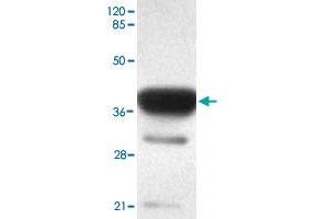 Western blot analysis of ACSS1 monoclonal antibody  at 1 : 2000 dilution interacts with recombinant ACSS1 protein with a GST tag. (ACSS1 Antikörper  (C-Term))
