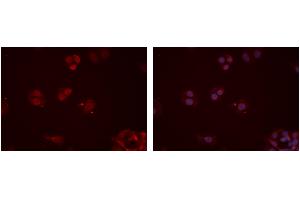 ABIN6277354 staining Hela cells by IF/ICC. (CX3CR1 Antikörper  (N-Term))