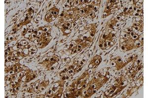 ABIN6275179 at 1/100 staining Human kidney tissue by IHC-P. (GNB5 Antikörper  (Internal Region))