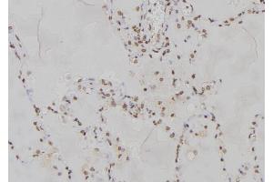 ABIN6277167 at 1/100 staining Human lung tissue by IHC-P. (PPP2R2A Antikörper  (Internal Region))