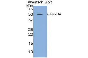 Western blot analysis of the recombinant protein. (FGL2 Antikörper  (AA 24-439))