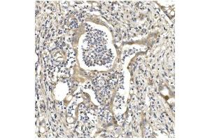 IHC analysis of Aconitase 1/ACO1 using anti-Aconitase 1/ACO1 antibody (ABIN7598988).