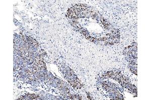 IHC analysis of CHCHD10 using anti-CHCHD10 antibody (ABIN7602507). (CHCHD10 Antikörper  (AA 80-142))