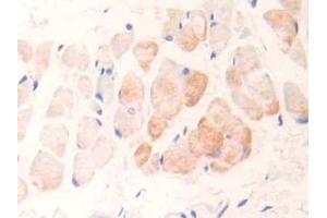 Detection of cTnI in Rat Skin Tissue using Polyclonal Antibody to Cardiac Troponin I (cTnI) (TNNI3 Antikörper  (AA 1-211))