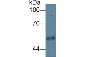Detection of CPE in Human Urine using Polyclonal Antibody to Carboxypeptidase E (CPE) (CPE Antikörper  (AA 318-476))