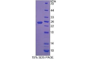 SDS-PAGE (SDS) image for Rh Family A Glycoprotein (RHAG) (AA 251-450) protein (His tag) (ABIN4988822)