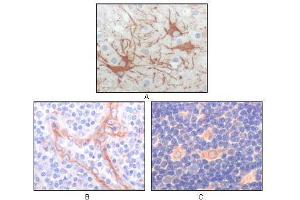 Immunohistochemical analysis of paraffin-embedded human cerebrum tumor (A), endothelium of vessel (B), lymphocyte of thymus(C), showing cytoplasmic localization using FES mouse mAb with DAB staining.