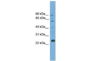 WB Suggested Anti-BCL7A Antibody Titration: 0. (BCL7A Antikörper  (Middle Region))