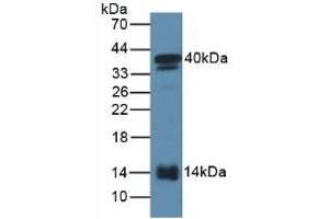 Detection of SAA2 in Mouse Serum using Polyclonal Antibody to Serum Amyloid A2 (SAA2) (SAA2 Antikörper  (AA 20-122))