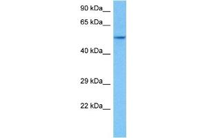 Host:  Rat  Target Name:  HNF4A  Sample Tissue:  Rat Skeletal Muscle  Antibody Dilution:  1ug/ml (HNF4A Antikörper  (Middle Region))