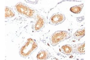 IHC staining of testis with gp100 antibody (HMB45). (Melanoma gp100 Antikörper)