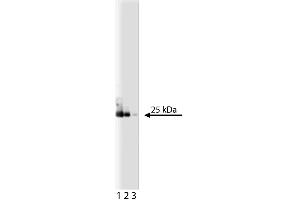 Western blot analysis of eIF-4E on a A431 lysate. (EIF4E Antikörper  (AA 1-217))