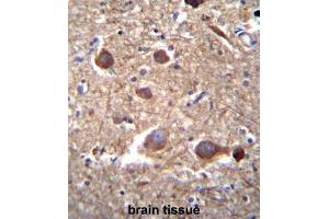 Immunohistochemistry (IHC) image for anti-Inositol-Trisphosphate 3-Kinase B (ITPKB) antibody (ABIN3003734) (ITPKB Antikörper)