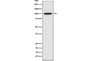 Western blot analysis of CTNNA3 expression in 293 cell lysate.