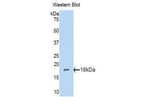 Western Blotting (WB) image for anti-Polybromo 1 (PBRM1) (AA 1152-1273) antibody (ABIN1860135) (Polybromo 1 Antikörper  (AA 1152-1273))