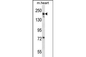 LRRC16B Antibody (C-term) (ABIN657937 and ABIN2846881) western blot analysis in mouse heart tissue lysates (35 μg/lane). (LRRC16B Antikörper  (C-Term))