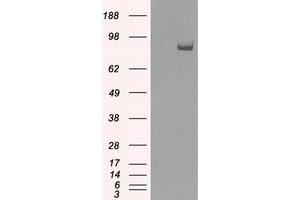 HEK293T cells were transfected with the pCMV6-ENTRY control (Left lane) or pCMV6-ENTRY SATB1 (Right lane) cDNA for 48 hrs and lysed. (SATB1 Antikörper)