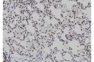 ABIN6277939 at 1/100 staining Rat lung tissue by IHC-P. (T-Bet Antikörper  (Internal Region))