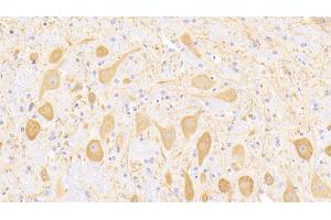 Detection of MAP2 in Rat Cerebellum Tissue using Polyclonal Antibody to Microtubule Associated Protein 2 (MAP2) (MAP2 Antikörper  (AA 1459-1718))