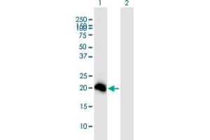 Western Blot analysis of N6AMT1 expression in transfected 293T cell line ( H00029104-T01 ) by N6AMT1 MaxPab polyclonal antibody.