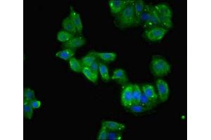 Immunofluorescent analysis of HepG2 cells using ABIN7150898 at dilution of 1:100 and Alexa Fluor 488-congugated AffiniPure Goat Anti-Rabbit IgG(H+L) (TCTE1 Antikörper  (AA 285-501))