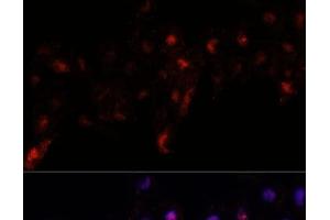 Immunofluorescence analysis of L929 cells using PEX10 Polyclonal Antibody at dilution of 1:100.