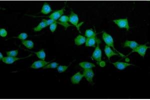 IF analysis of TRIM25/EFP using anti-TRIM25/EFP antibody (ABIN7599491).