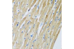 Immunohistochemistry of paraffin-embedded rat heart using ADAM12 antibody. (ADAM12 Antikörper  (AA 589-738))