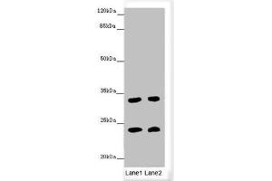 Western blot All lanes: MRAS antibody at 3. (MRAS Antikörper  (AA 79-208))