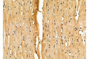 ABIN6264038 and ABIN6276439 at 1/100 staining Rat heart tissue by IHC-P.
