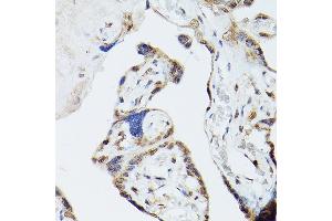Immunohistochemistry of paraffin-embedded human placenta using ADK Rabbit pAb (ABIN7265463) at dilution of 1:300 (40x lens). (ADK Antikörper  (AA 200-345))