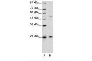 Image no. 1 for anti-Zinc Finger and SCAN Domain Containing 20 (ZSCAN20) (N-Term) antibody (ABIN203137) (ZSCAN20 Antikörper  (N-Term))