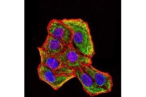 Immunofluorescence analysis of Hela cells using KRT18 mouse mAb (green). (Cytokeratin 18 Antikörper  (AA 1-150))