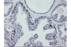 Image no. 8 for anti-Meis Homeobox 3 (MEIS3) (AA 1-261) antibody (ABIN1490671) (MEIS3 Antikörper  (AA 1-261))