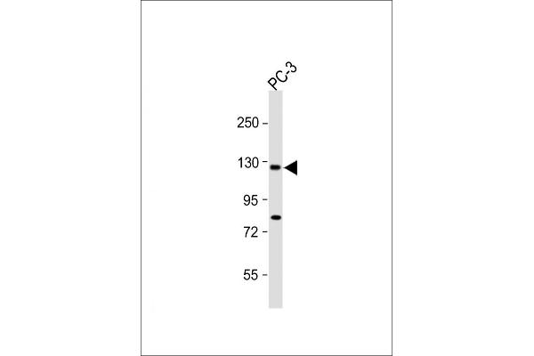 TRPM8 Antikörper  (C-Term)