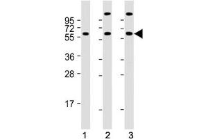 Western blot testing of human 1) K562, 2) 293 and 3) Jurkat cell lysate with HSP60 antibody. (HSPD1 Antikörper  (AA 80-109))