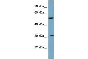Host: Rabbit Target Name: DKK1 Sample Type: PANC1 Whole Cell lysates Antibody Dilution: 1. (DKK1 Antikörper  (C-Term))