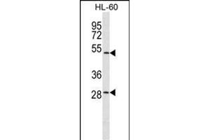 ZN Antibody (C-term) (ABIN1537399 and ABIN2849742) western blot analysis in HL-60 cell line lysates (35 μg/lane).