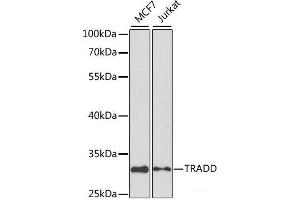 Western blot analysis of extracts of various cell lines using TRADD Polyclonal Antibody at dilution of 1:1000. (TRADD Antikörper)