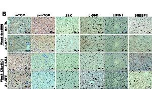 Immunohistochemistry (IHC) image for anti-Mechanistic Target of Rapamycin (serine/threonine Kinase) (mTOR) (C-Term) antibody (ABIN2855088)
