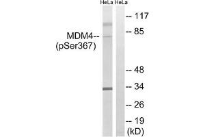 Western blot analysis of extracts from HeLa cells, treated with calyculinA (50 ng/mL, 30 mins), using MDM4 (Phospho-Ser367) antibody. (MDM4-binding Protein Antikörper  (pSer367))