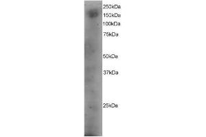 Image no. 1 for anti-Dedicator of Cytokinesis 1 (DOCK1) (C-Term) antibody (ABIN374114) (DOCK1 Antikörper  (C-Term))