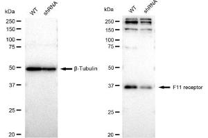 Western blotting analysis using F11 receptor antibody (ABIN7798557). (Rekombinanter F11R Antikörper)