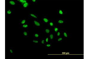 Immunofluorescence of purified MaxPab antibody to PHF10 on HeLa cell. (PHF10 Antikörper  (AA 1-410))