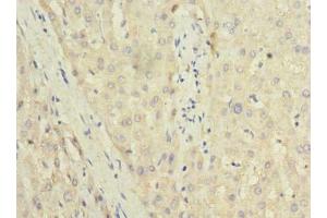 Immunohistochemistry of paraffin-embedded human liver tissue using ABIN7173508 at dilution of 1:100