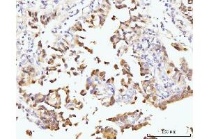 IHC analysis of Nucleostemin/GNL3 using anti-Nucleostemin/GNL3 antibody (ABIN7601778). (Nucleostemin Antikörper  (AA 45-549))