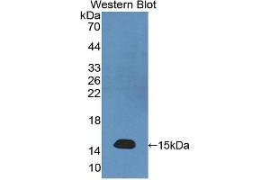 Western Blotting (WB) image for anti-Neurofilament, Light Polypeptide (NEFL) (AA 281-396) antibody (ABIN1176228) (NEFL Antikörper  (AA 281-396))